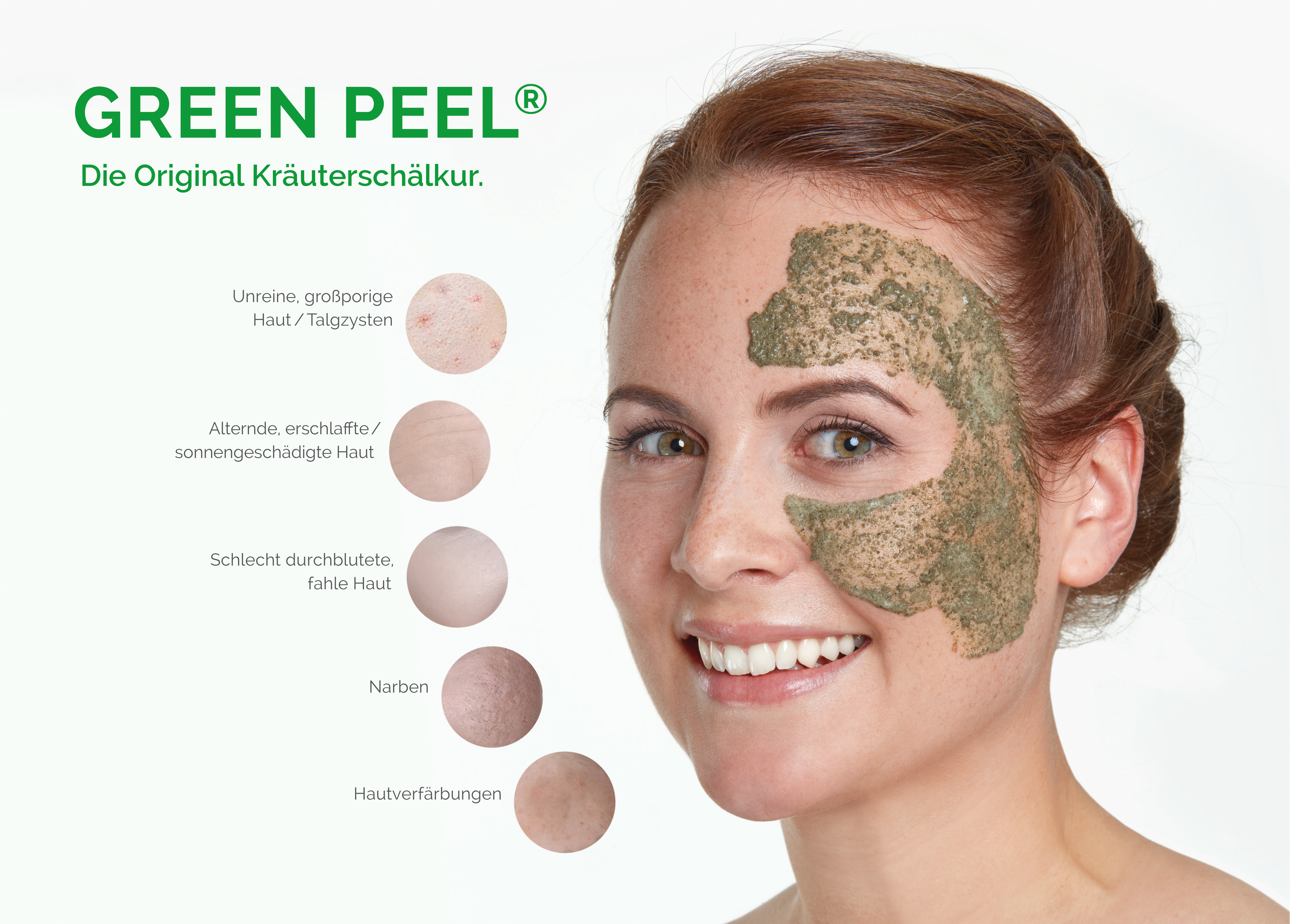 Green Peel 